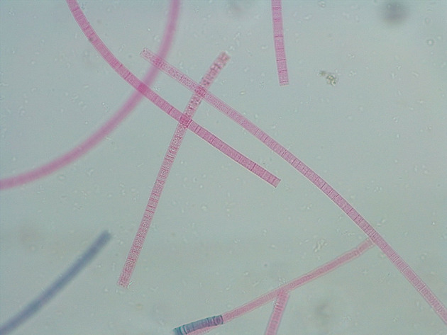Oscillatoria Slides - Oscillatoria 02 100X